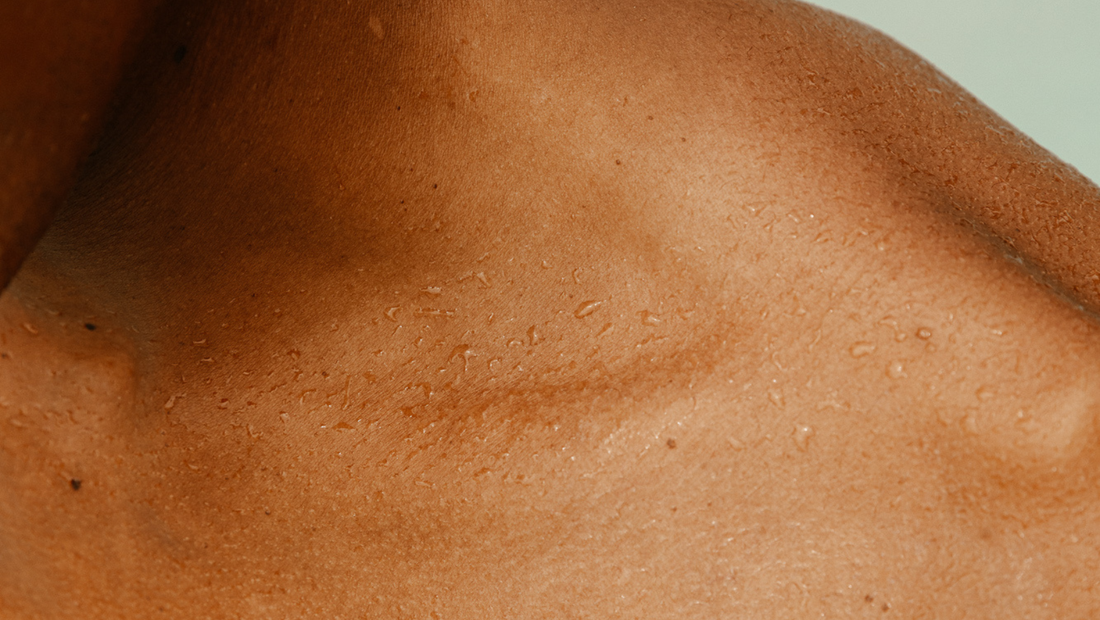Skin Detox: Essential Insights You Need to Know